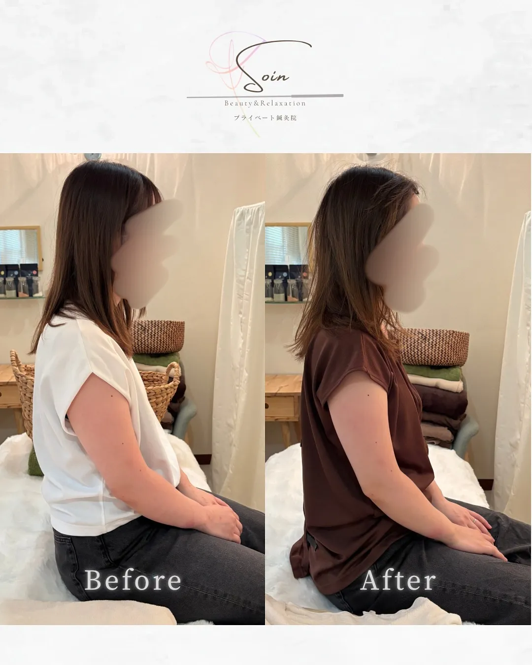 《 全身調整鍼 Before / After 》